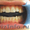 Отбеливание зубов. Восстановление, лечение, удаление - Изображение #4, Объявление #1335601