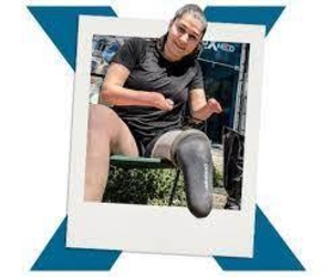 Luxmed - Get Above Knee Prosthetic Leg in Russia - Изображение #1, Объявление #1729891